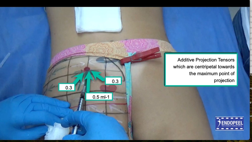 additive-centripetal-projection-tensors