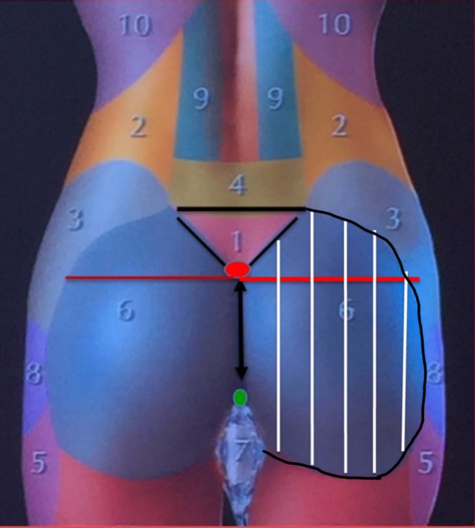 division-vertical-lines