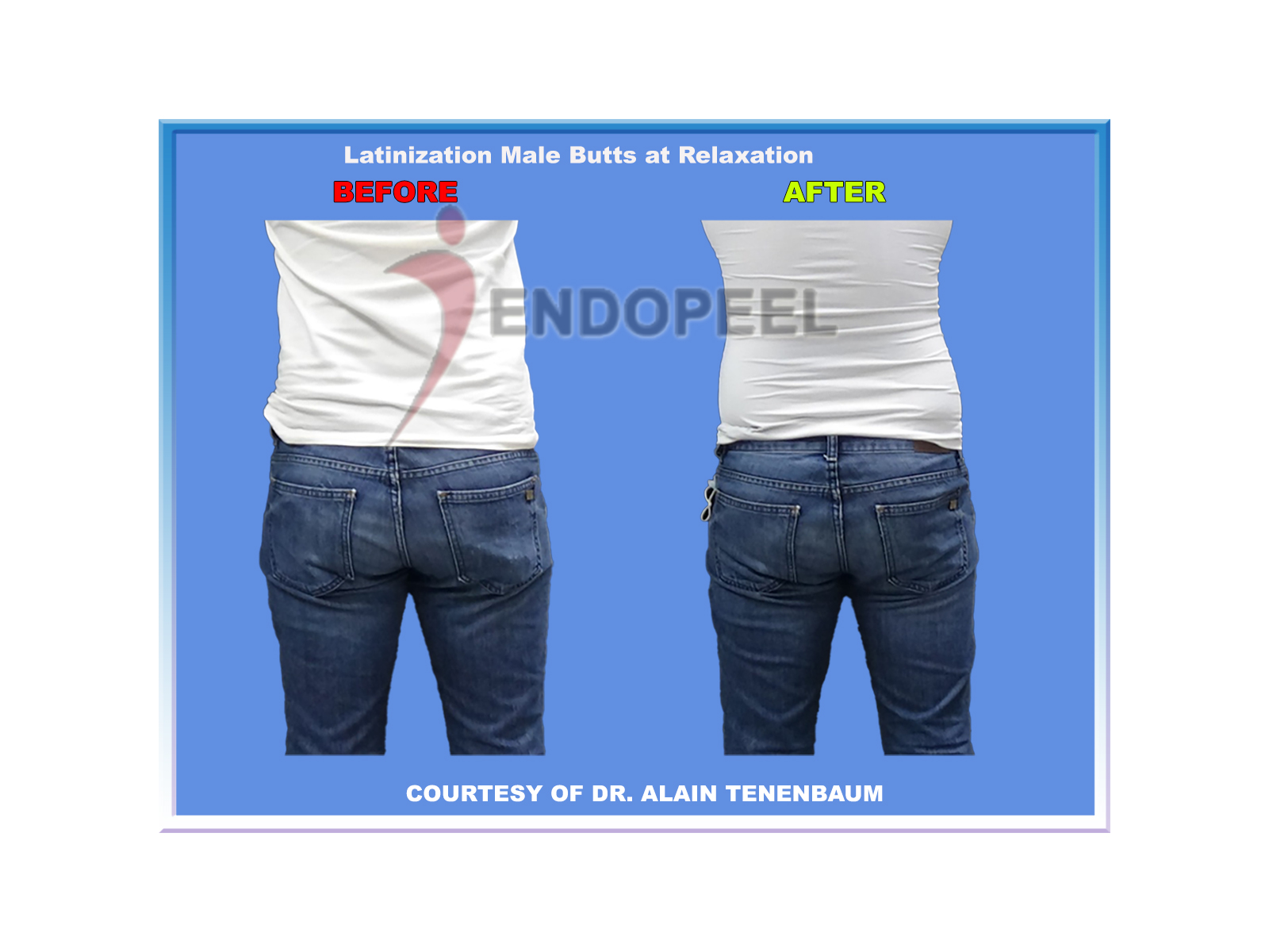 Latinization of Male Butts at Relaxation