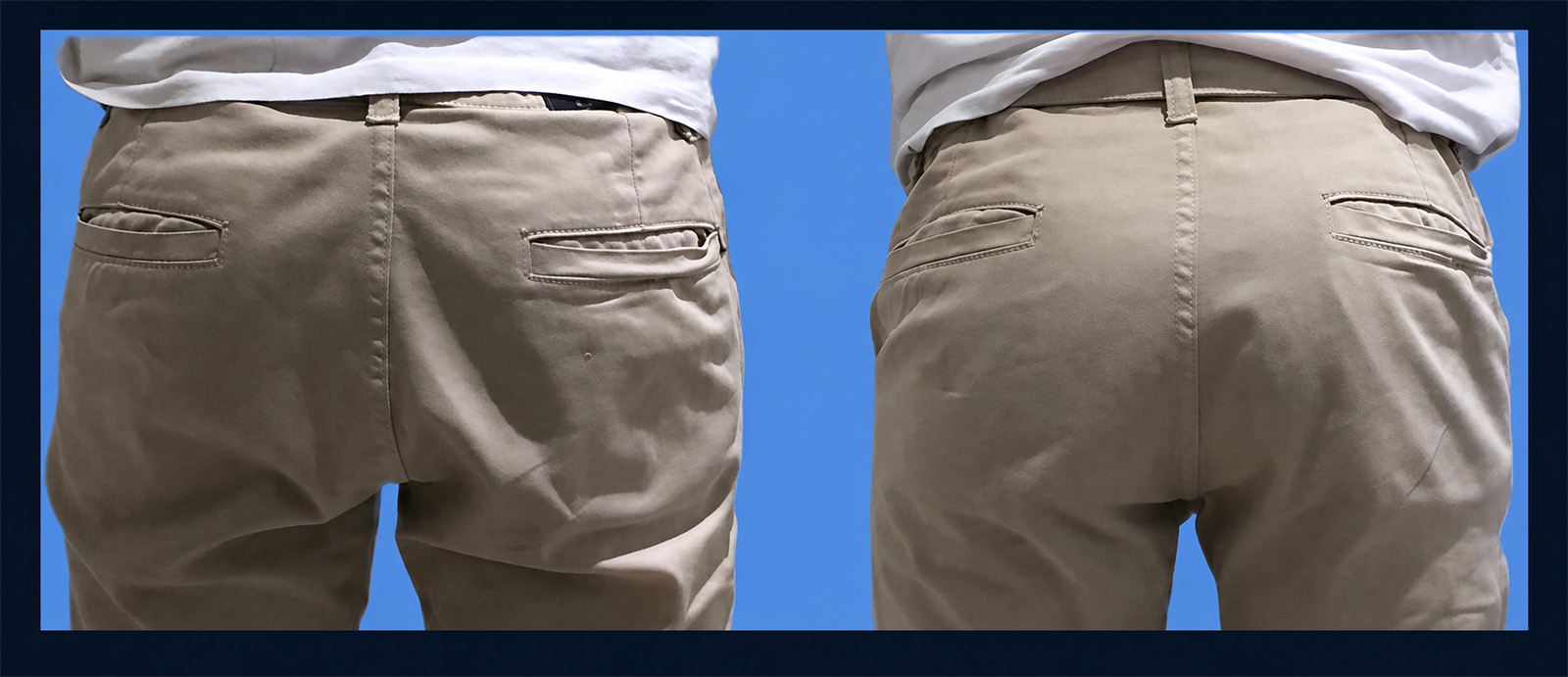 Before and after comparison of athletic male gluteal contour refinement