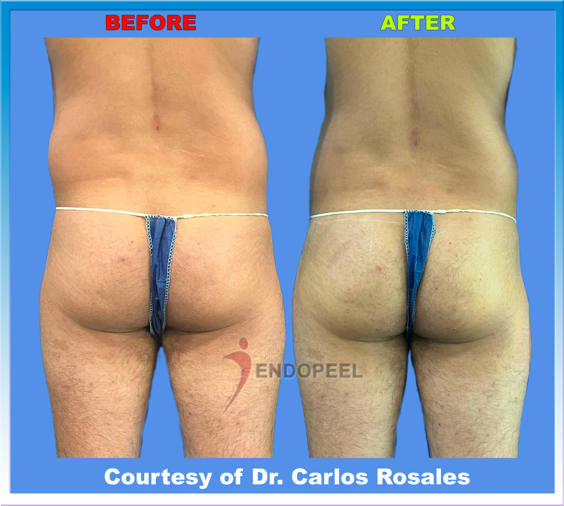  mature-man-back-falling-butt