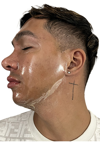 adrian-profile-l-30min-peel-off