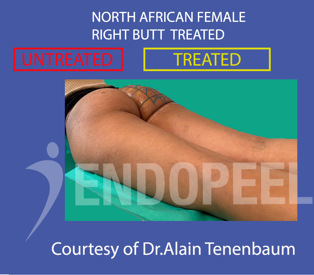 north african female butt  profile