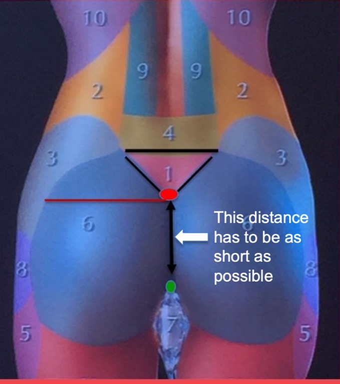 aesthetic-vertical-distance