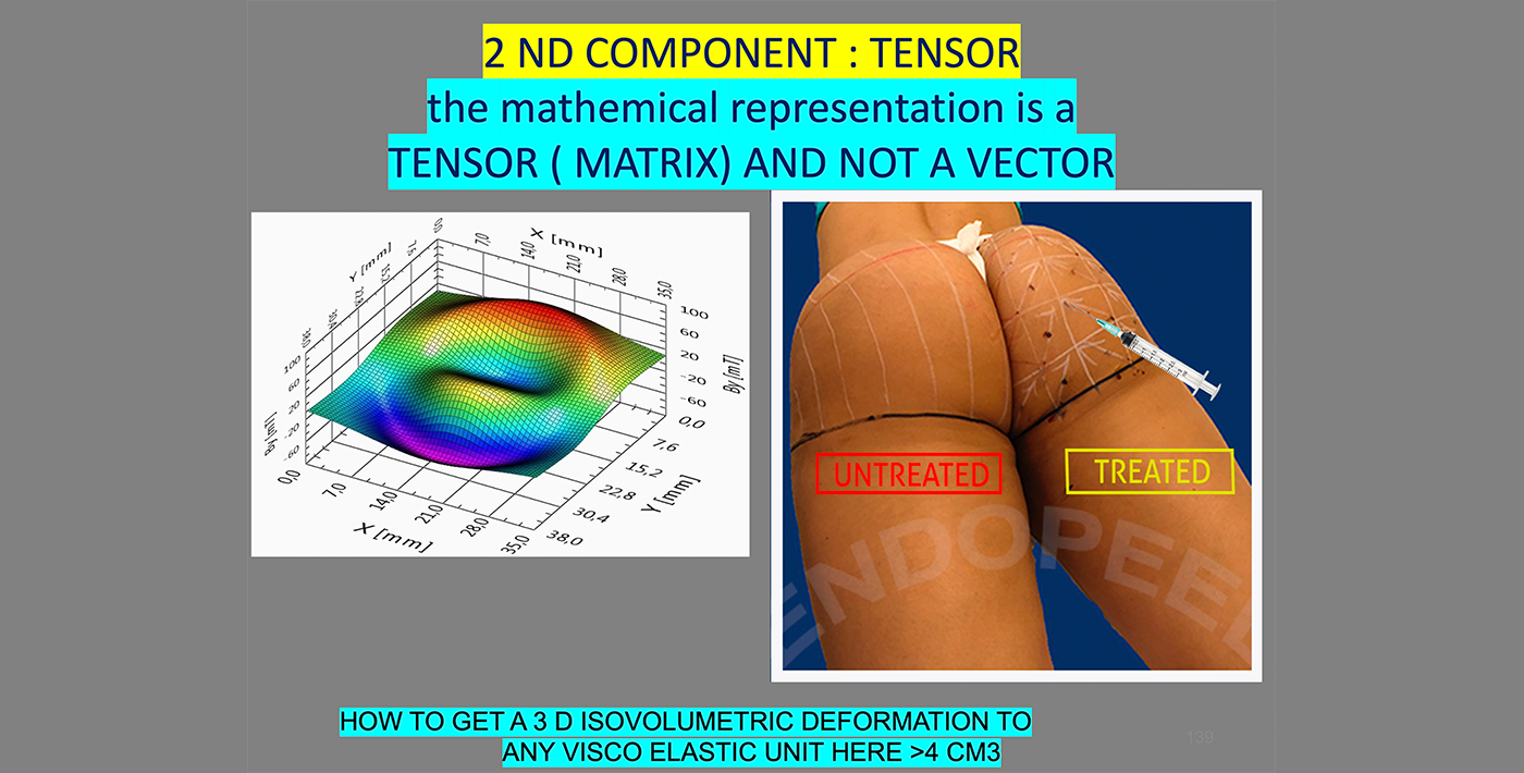 tensor-gluteoplasty