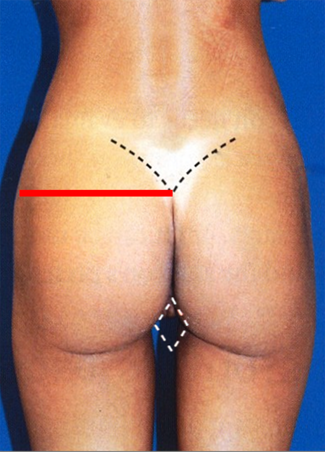 red line in practise