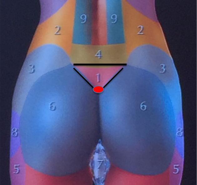 Inferior Point of the PreSacral Triangle