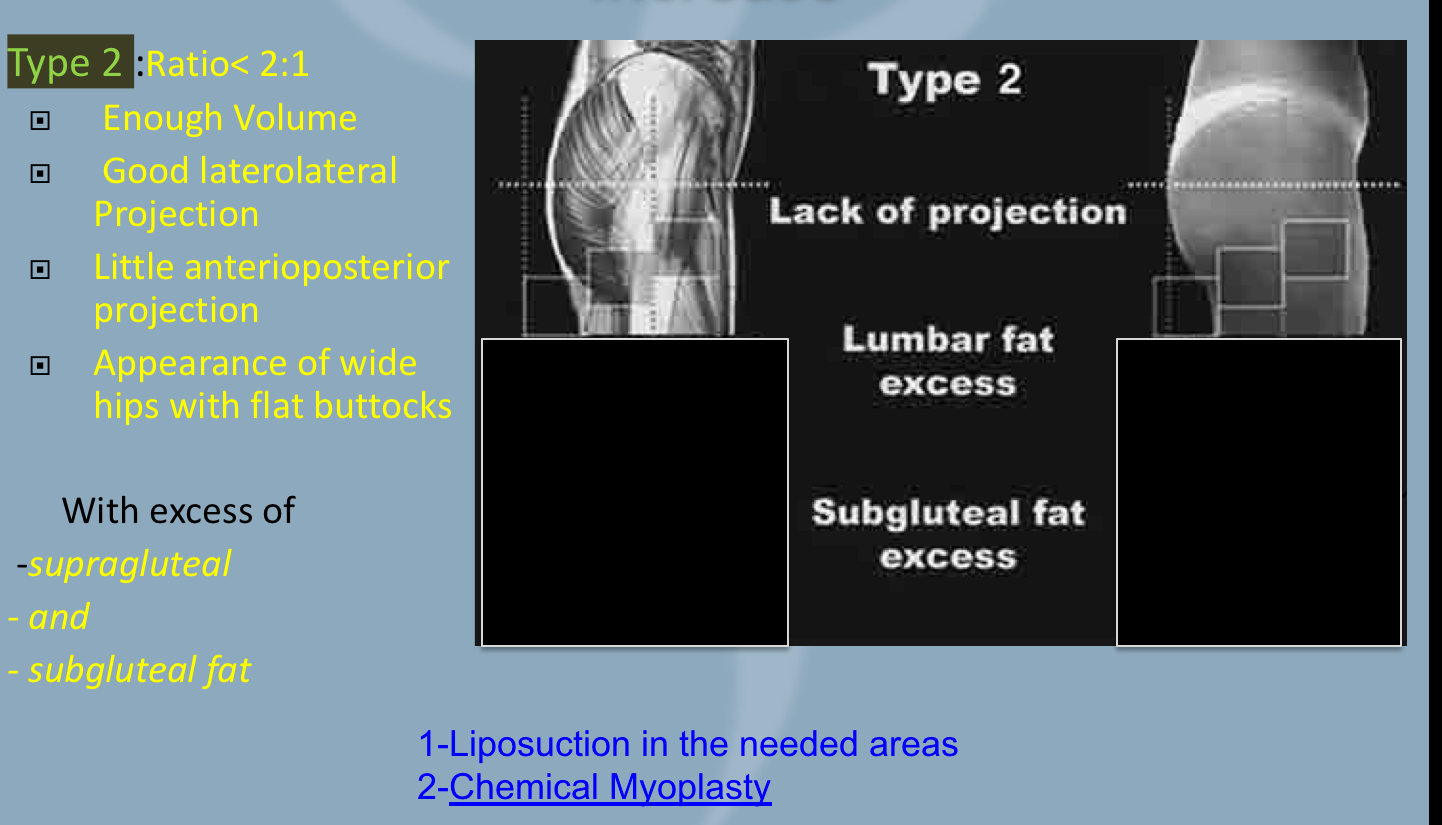 type 2 white female butts