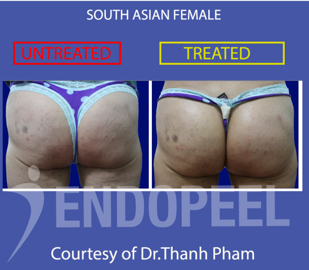 south asian female butt front