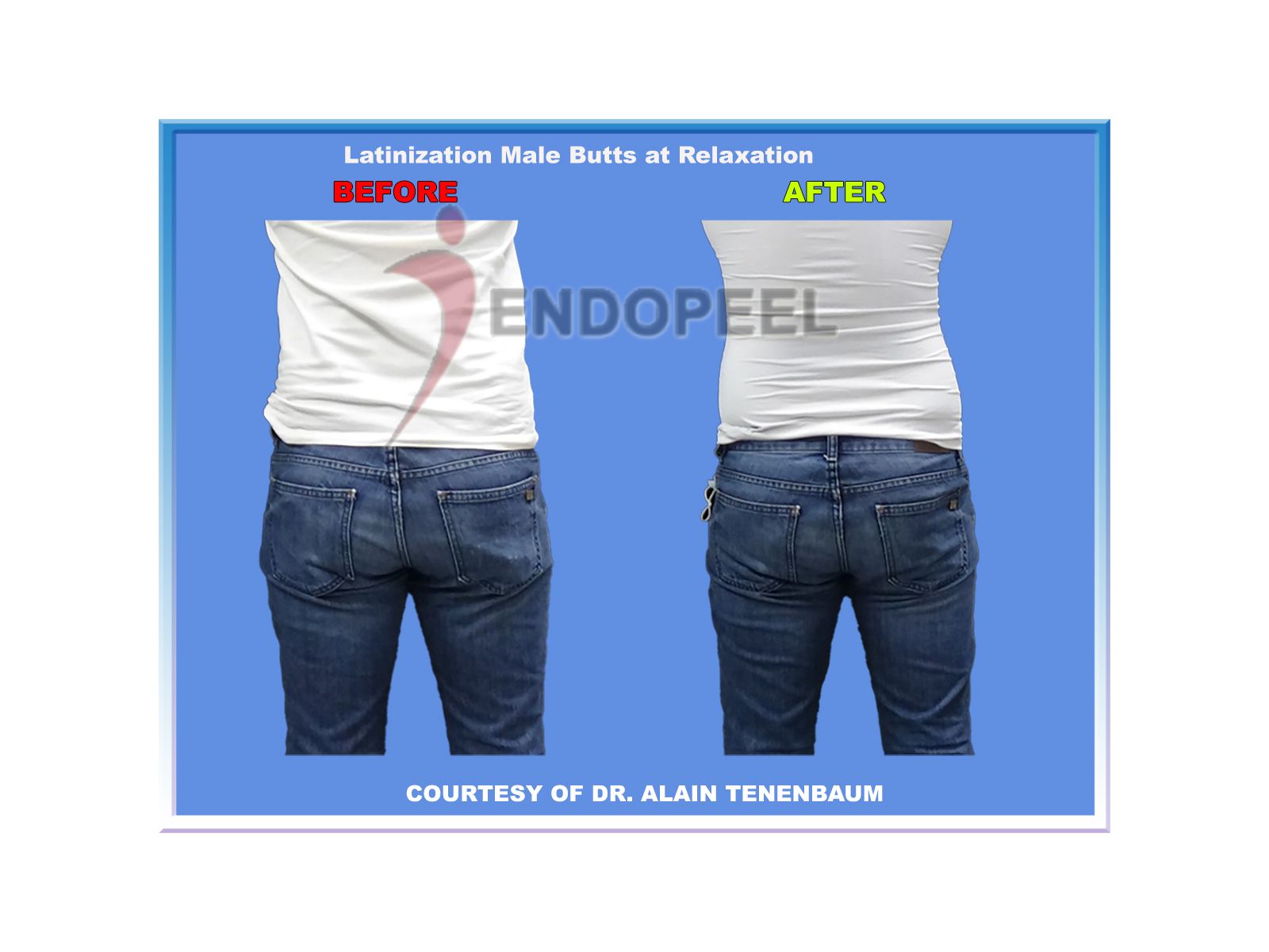  Latinization of  Male Butts at Relaxation