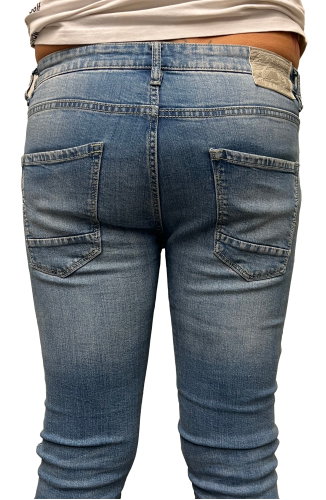 jeans-with-prosthesis-before-endopeel.