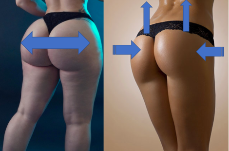 latinisation by enlargement 