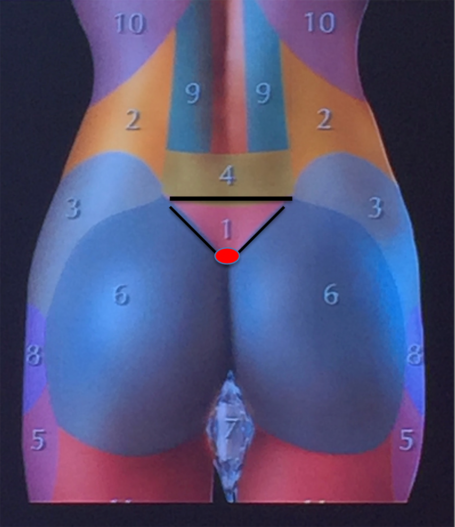 pre sacral triangle