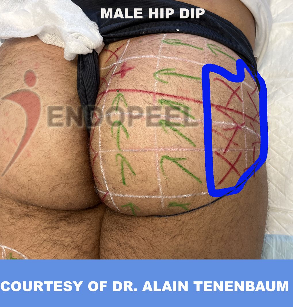 male hip dip