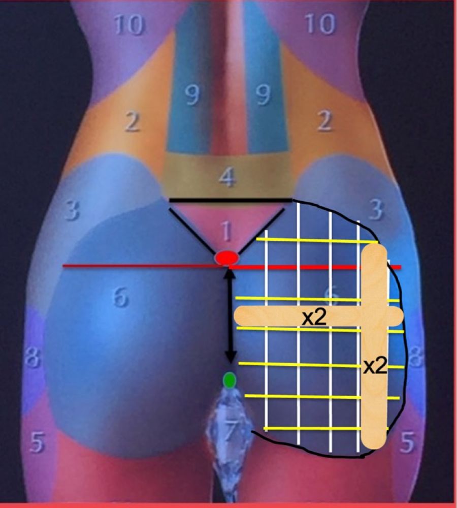 gluteal-squares